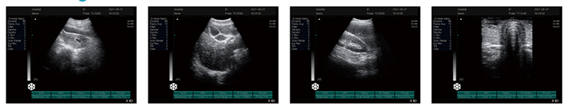 veterinary b/w portable ultrasound scanner 4